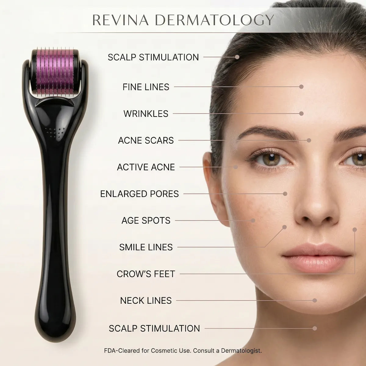Revina Dermatology roller device with labeled skin conditions on a woman's face.