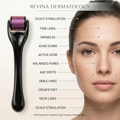Revina Dermatology roller device with labeled skin conditions on a woman's face.