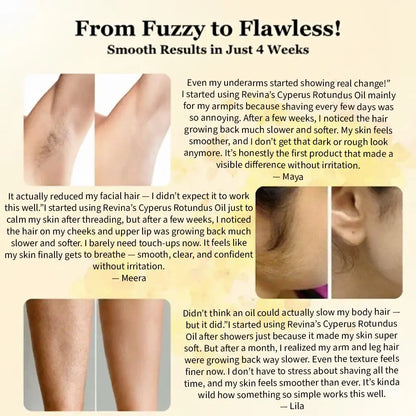 Revina Cyperus Rotundus Oil for Natural Permanent Hair Reduction